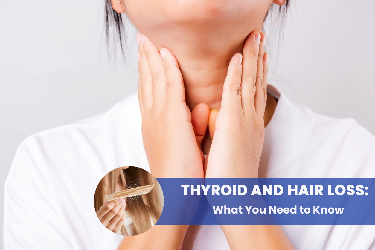 Thyroid and Hair Loss: What You Need to Know