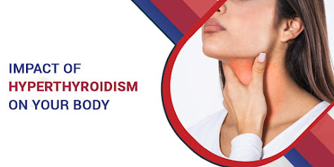 Impact of Hyperthyroidism on Your Body